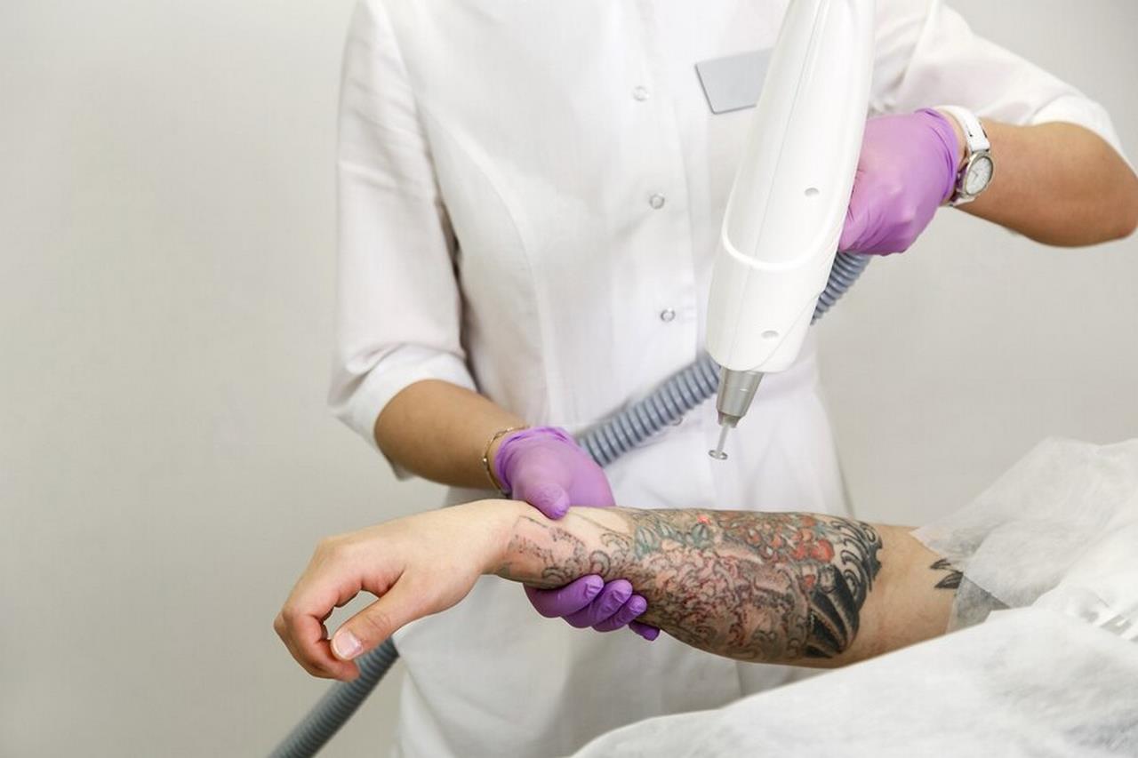 Czego używać, aby podtrzymać skórę po laserowym usuwaniu tatuażu?