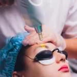 Czy laserowe usuwanie makijażu permanentnego jest trwałe?